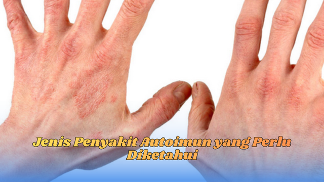 jenis penyakit autoimun
