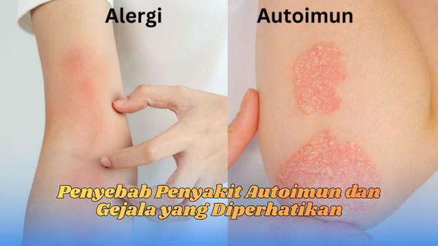 penyebab penyakit autoimun
