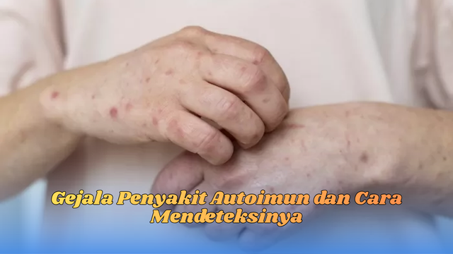 gejala penyakit autoimun