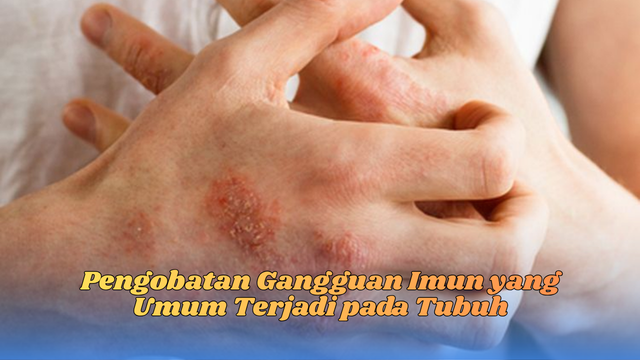 pengobatan gangguan imun