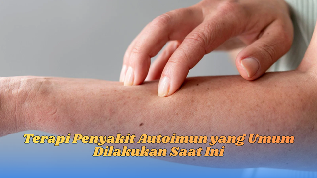 terapi penyakit autoimun