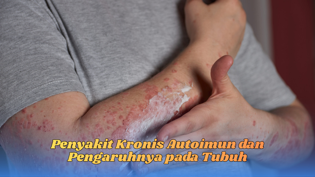 penyakit kronis autoimun