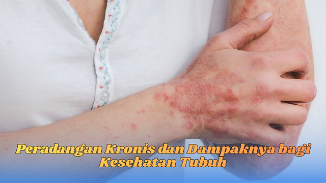 peradangan kronis